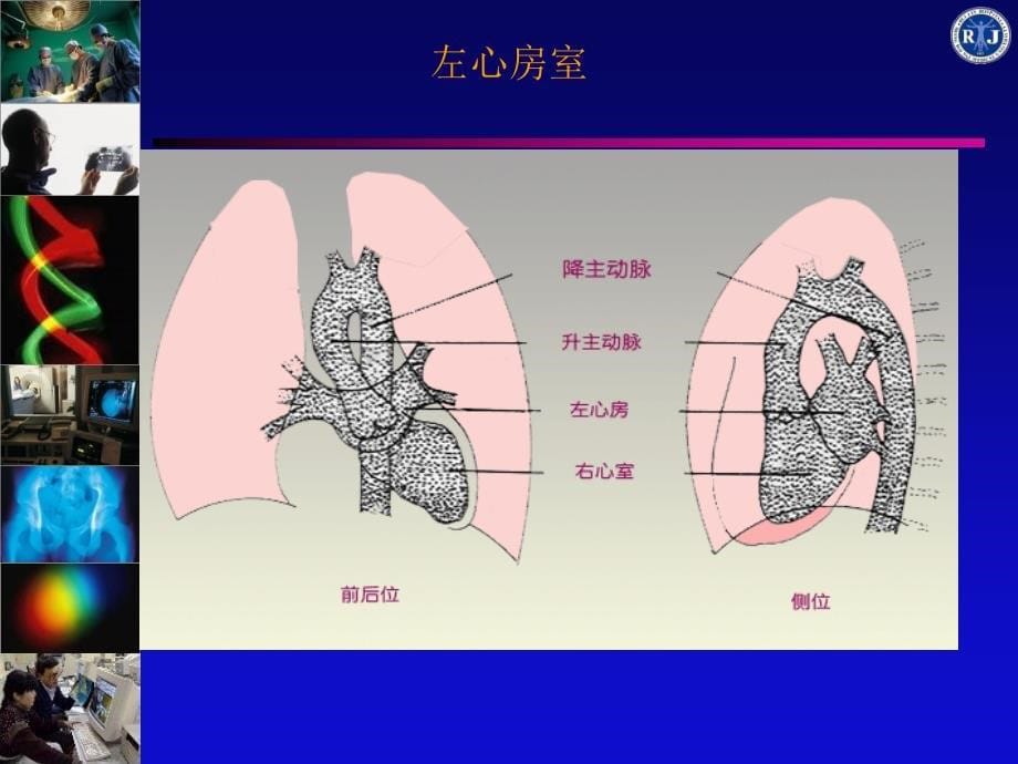 循环系统正常表现pt课件_第5页