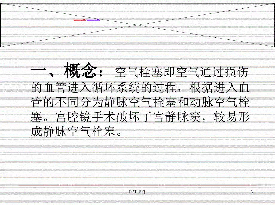 宫腔镜手术并发症空气栓塞ppt课件_第2页