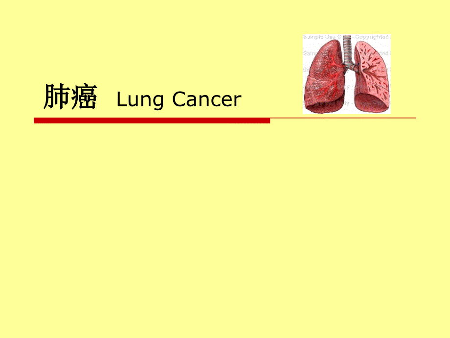 外科学教学课件：肺癌Lung Cancer_第1页