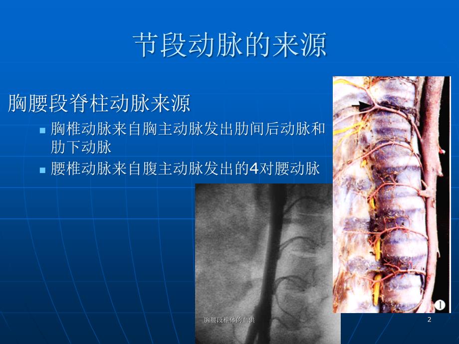 胸腰段椎体的血供ppt课件_第2页