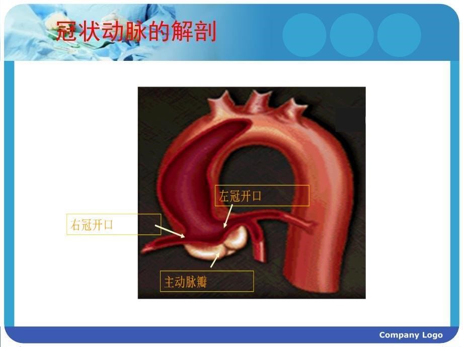 冠状动脉造影术及其护理_第5页