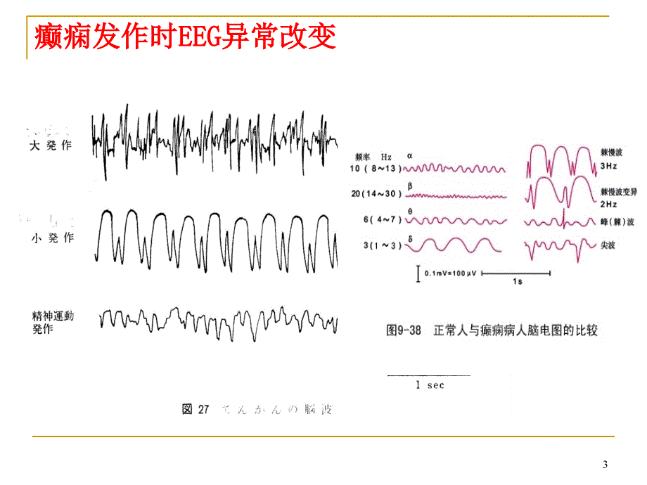 抗癫痫药注意事项_第3页