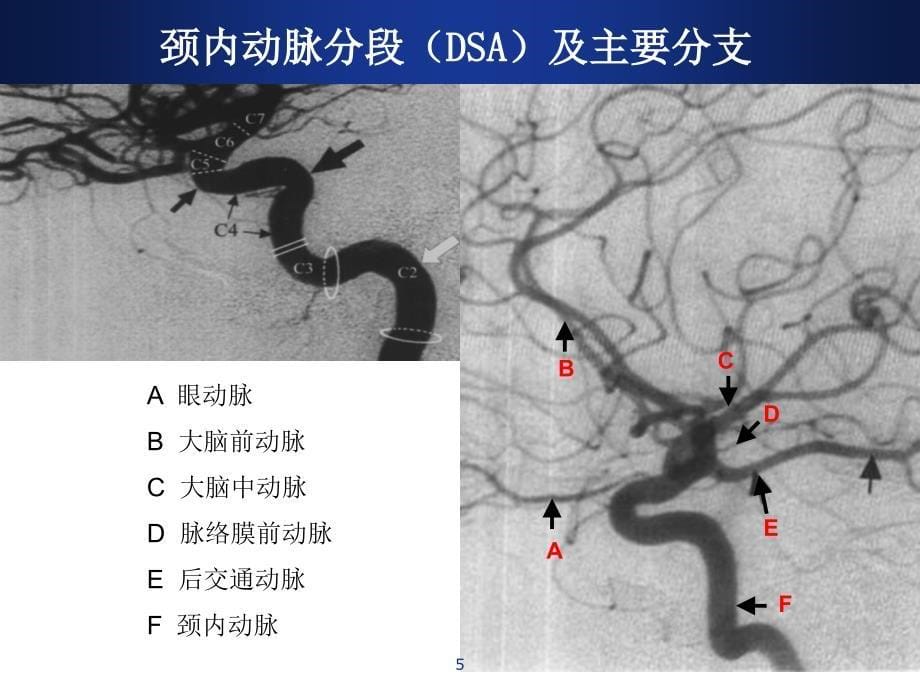 （精选课件）脑血管解剖及DSA阅片解读_第5页