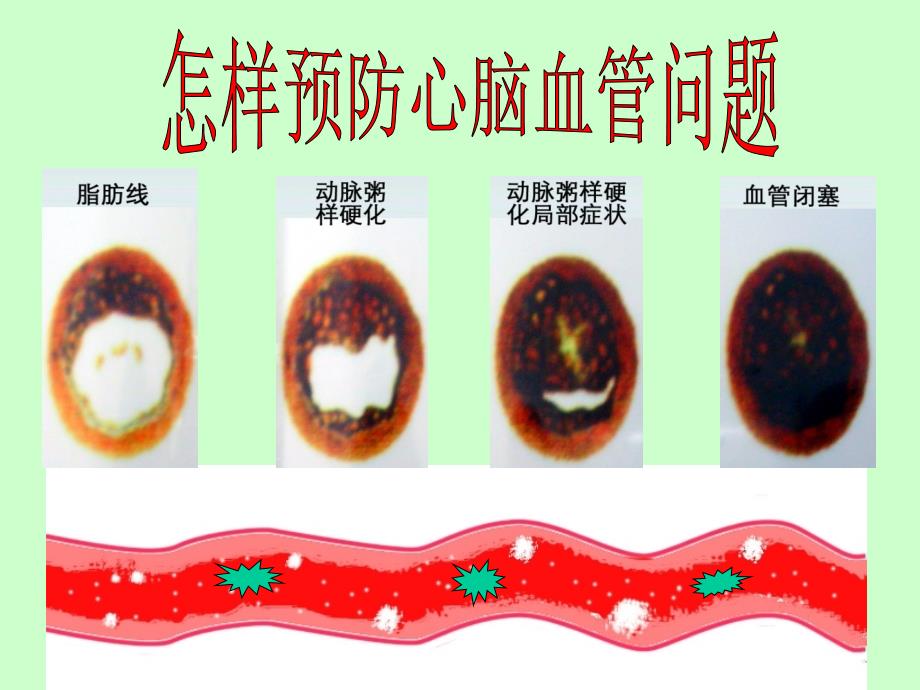 怎样清洗血管.ppt_第1页