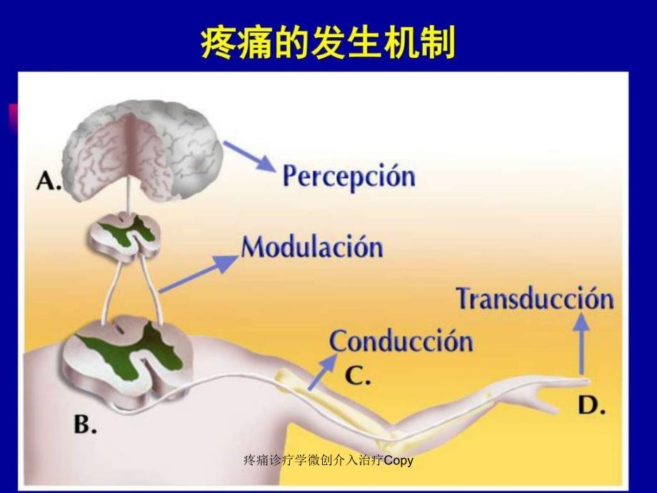 疼痛诊疗学微创介入治疗Copy课件_第3页