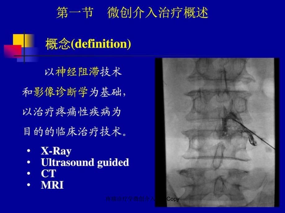 疼痛诊疗学微创介入治疗Copy课件_第4页
