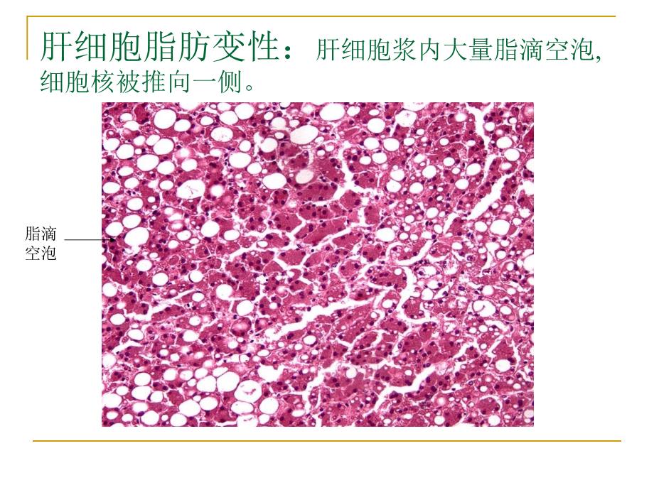 病理学实验切片考试图片_第3页