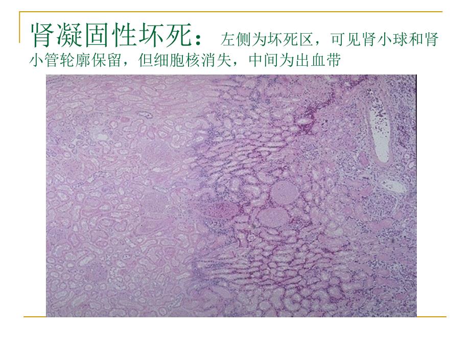 病理学实验切片考试图片_第4页