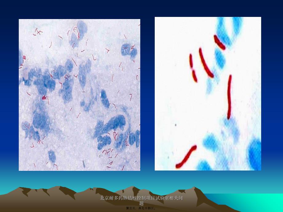 北京耐多药肺结核控制项目试验室相关问题课件_第3页