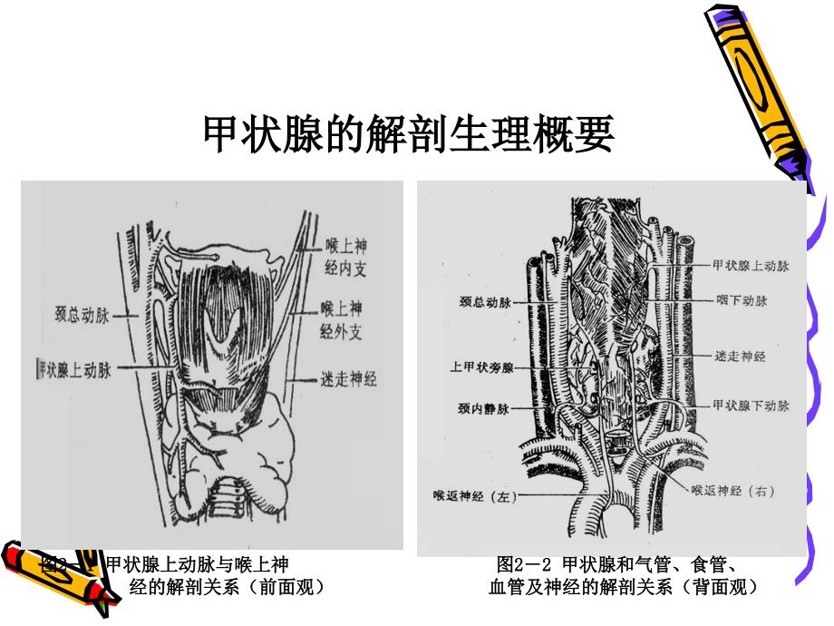 甲状腺疾病病人的护理ppt_第3页