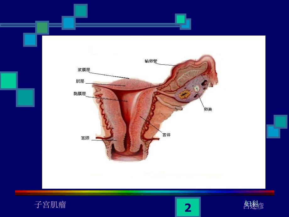 子宫肌瘤课件_第2页