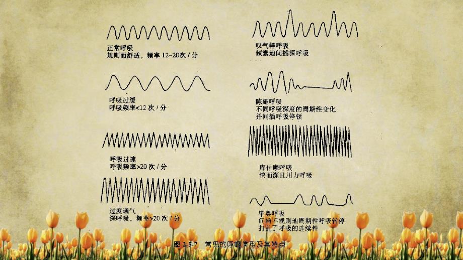 呼吸困难患者的紧急护理精选_第4页