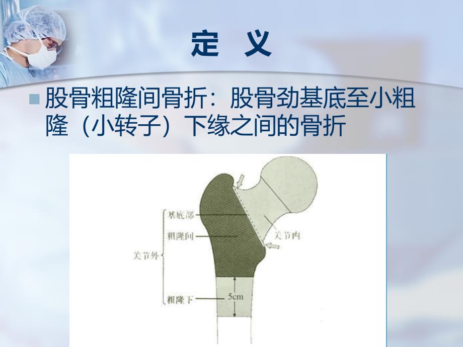 股骨粗隆间骨折-PPT课件_第2页