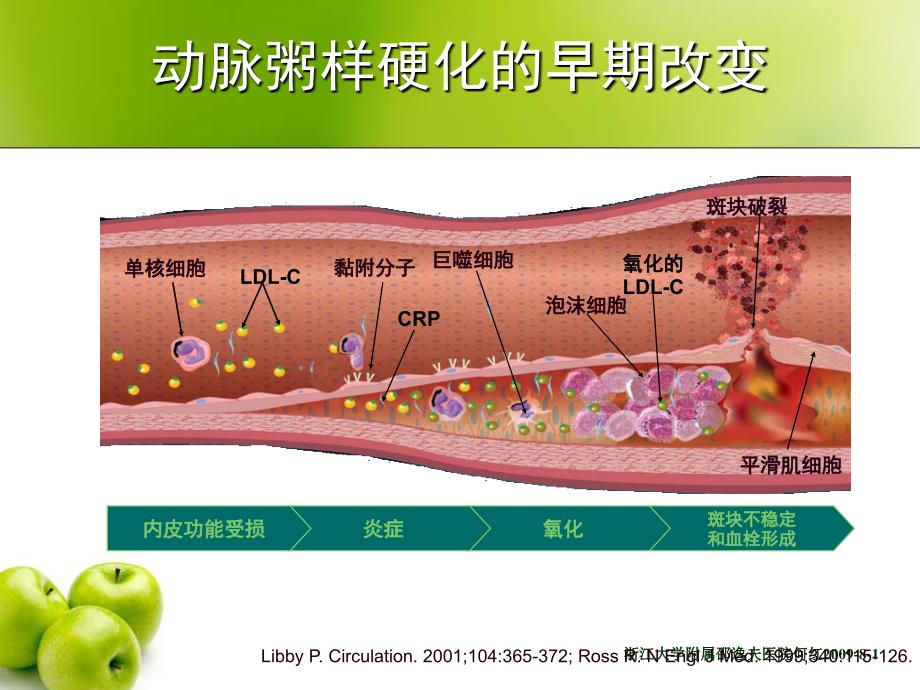 crp升高是动脉粥样硬化的因还是果何红精选文档_第4页