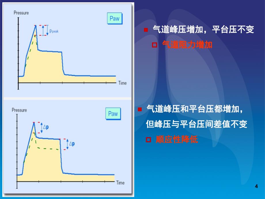 肺顺应性与临床课堂PPT_第4页