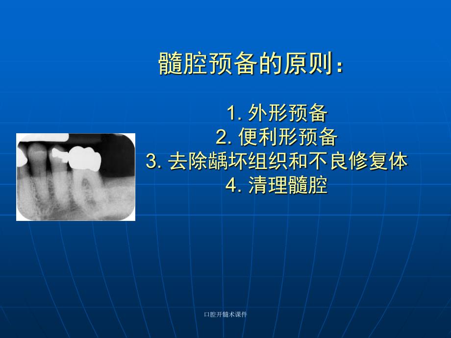 口腔开髓术课件经典实用_第1页