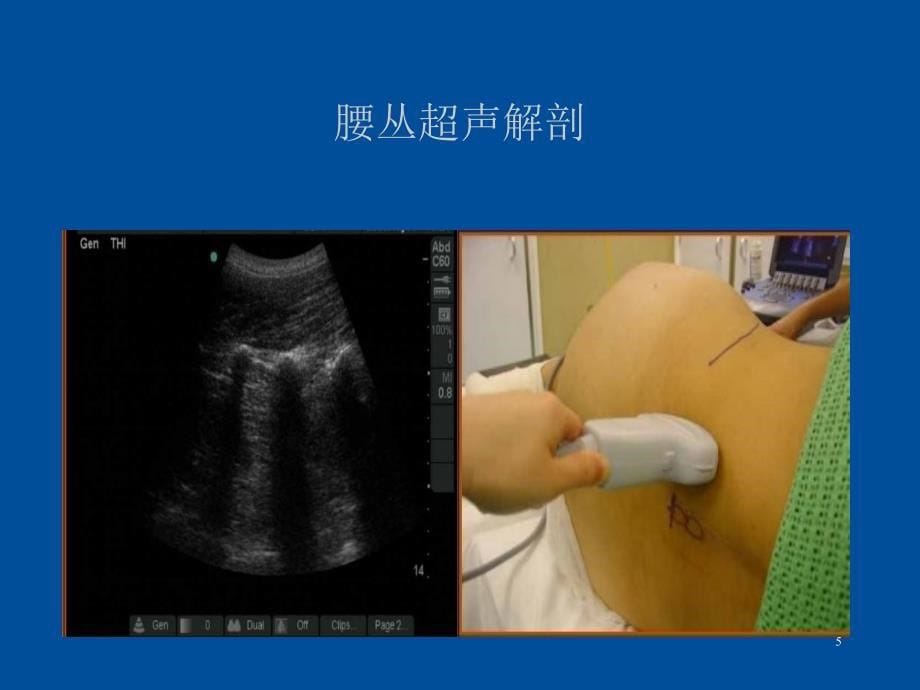 超声引导下的神经阻滞下肢篇PPT_第5页