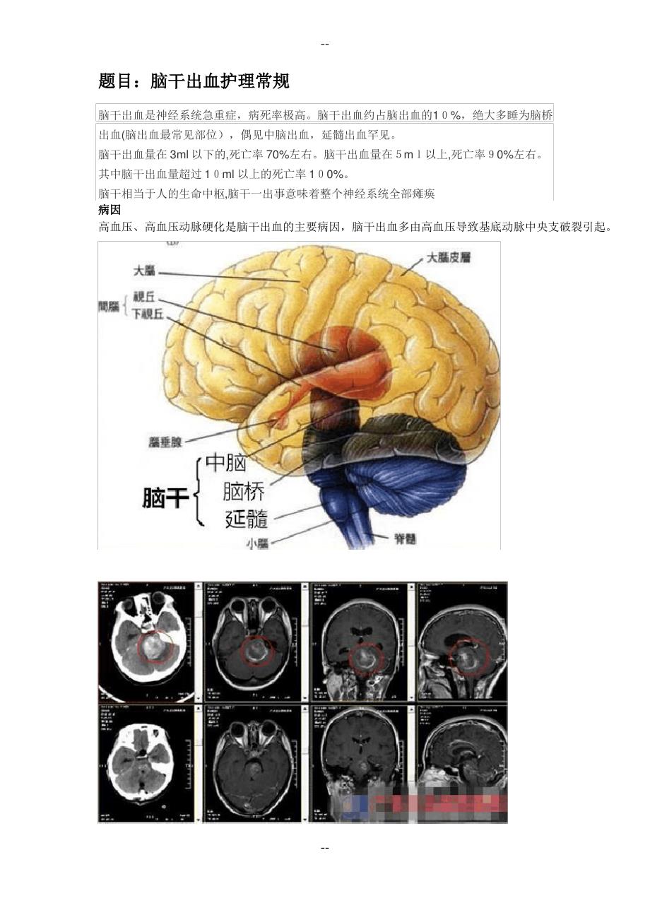 脑干出血护理常规_第1页