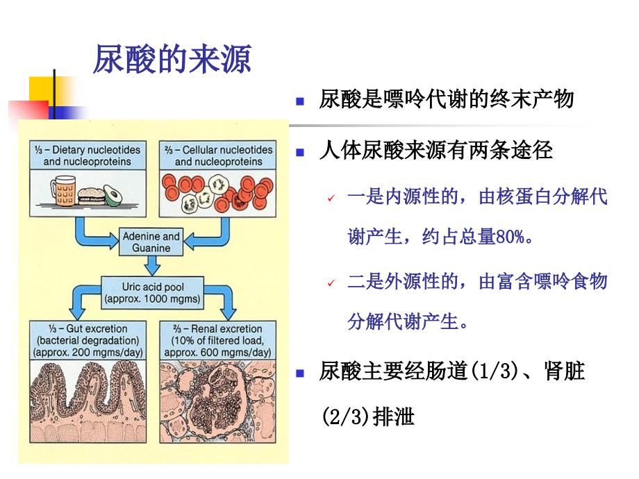 痛风性肾病护理查房_第2页