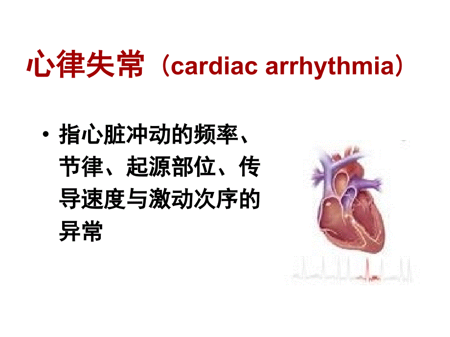 心律失常课件_第1页