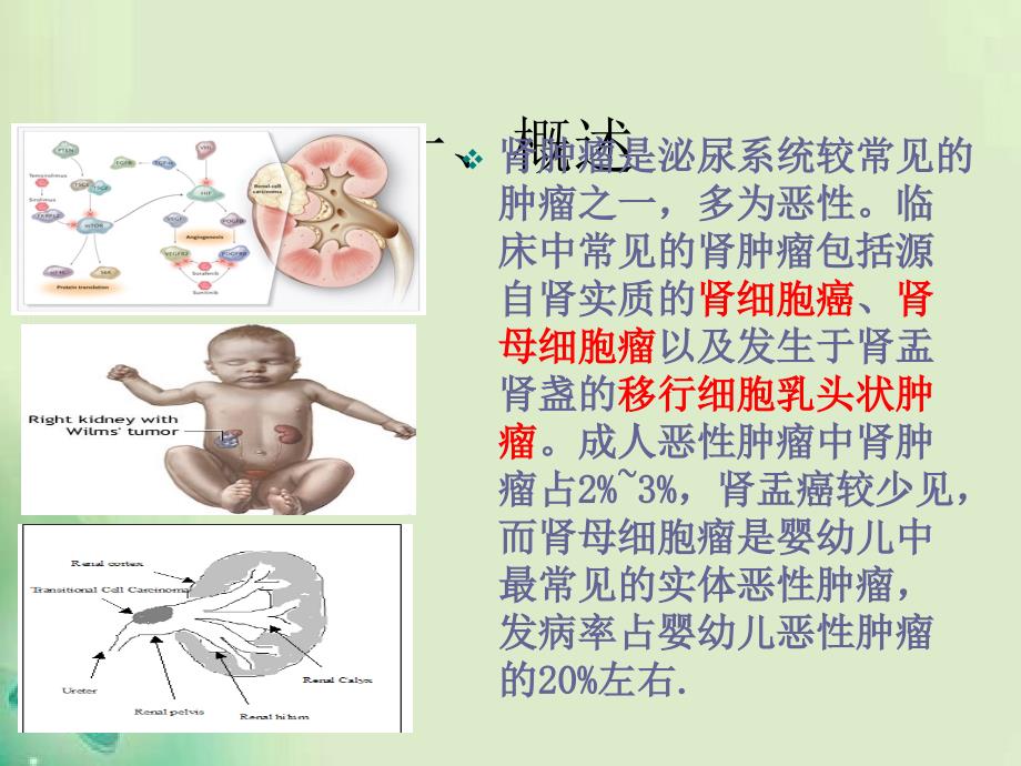 肾癌护理查房_第2页