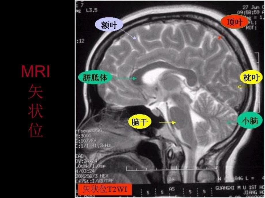 现代头颅影像解剖诊断_第5页