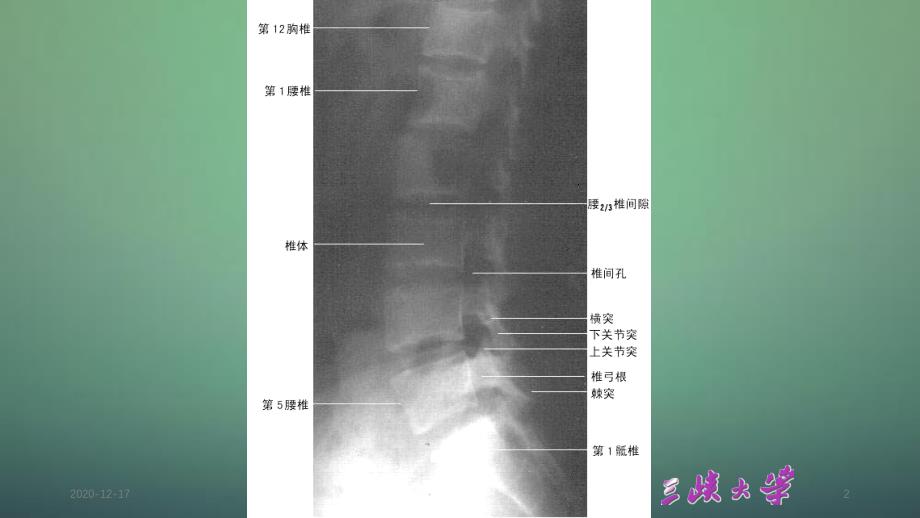 腰椎影像解剖学精选干货_第2页