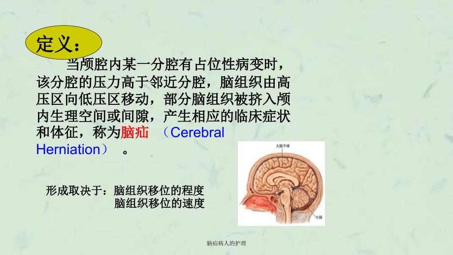 脑疝病人的护理课件_第3页