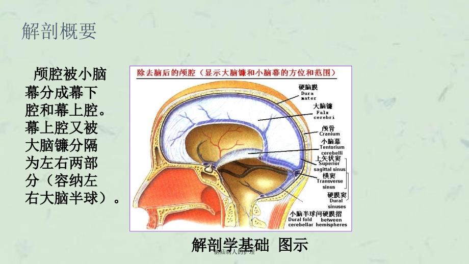 脑疝病人的护理课件_第4页