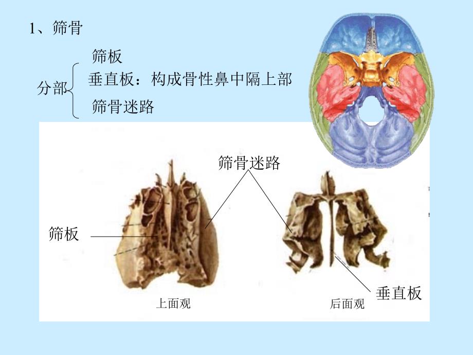 人体解剖学：3-颅骨-五年制_第4页