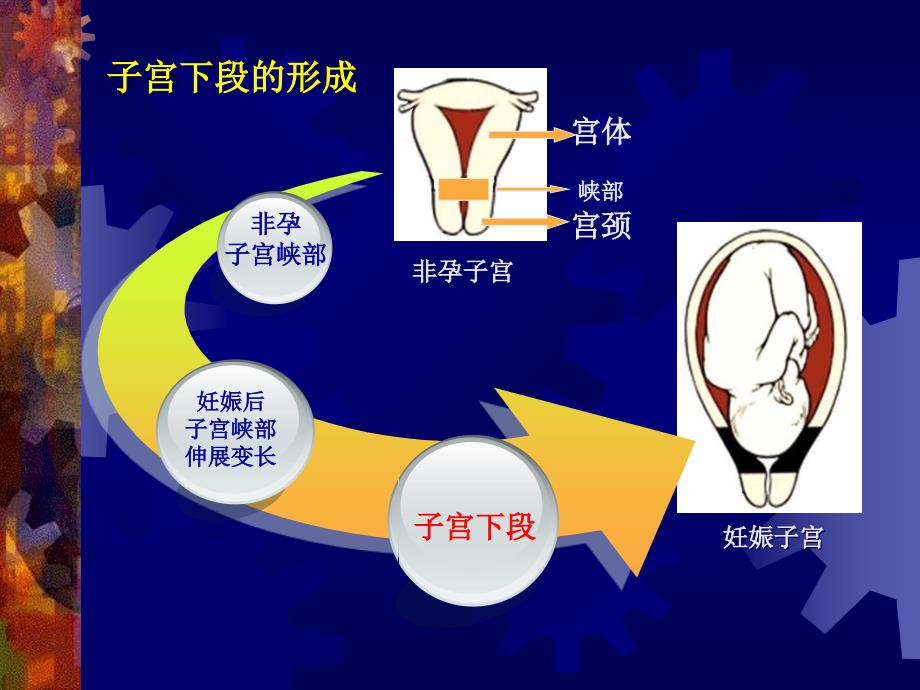 妇产科学胎盘与胎膜异常第一节前置胎盘_第4页