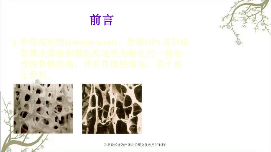 骨质疏松症治疗药物的研究及应用PPT课件_第4页