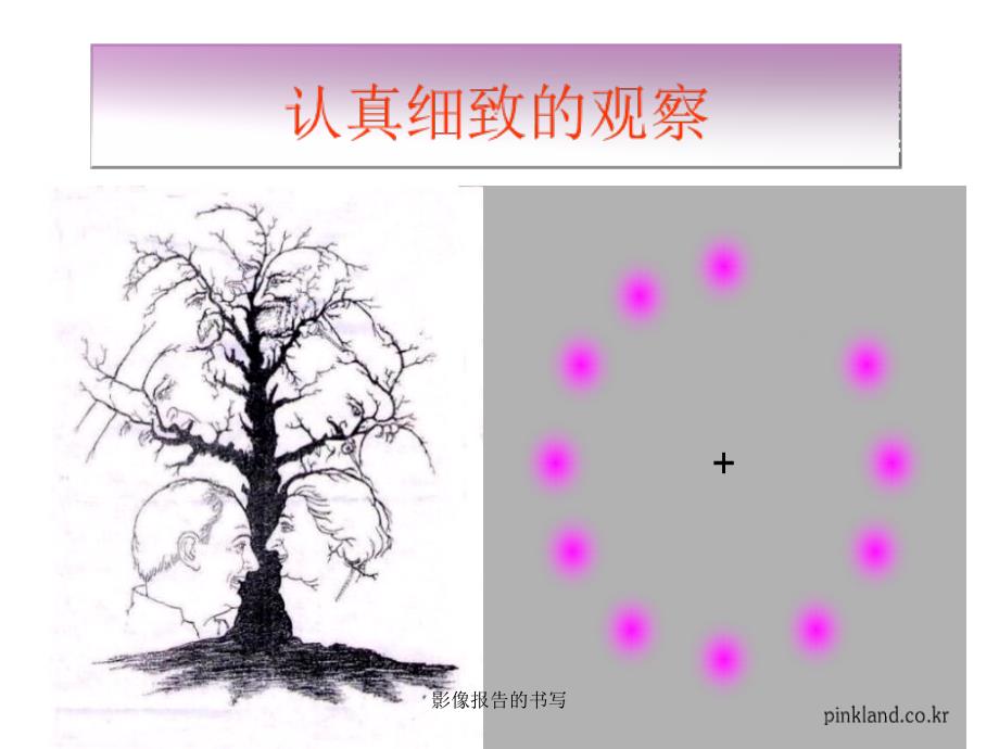 影像报告的书写课件_第4页