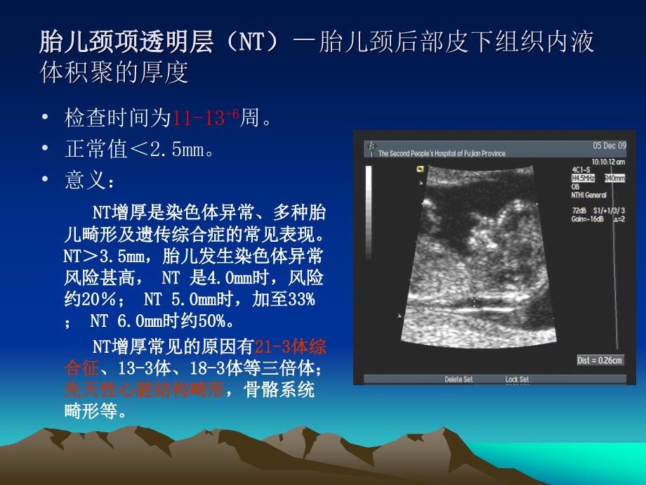 产科超声检查指标.ppt_第4页