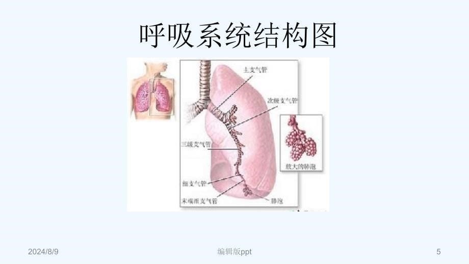 肺炎的护理PPT课件_第5页