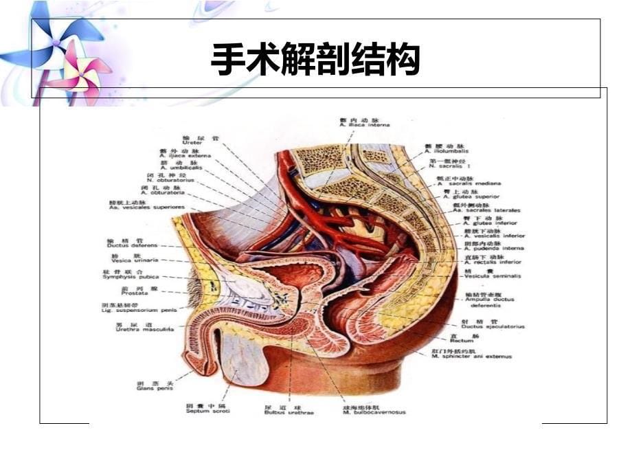 全膀胱切除护理查房ppt课件_第5页