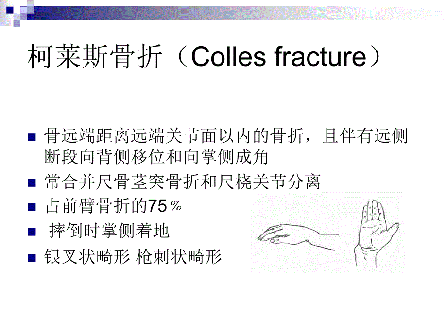 上肢骨折常见类型_第2页