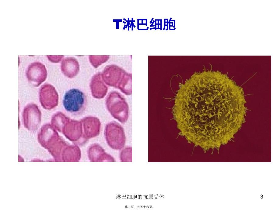 淋巴细胞的抗原受体课件_第3页