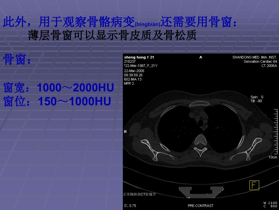 正常胸肺部CT影像学课件_第3页