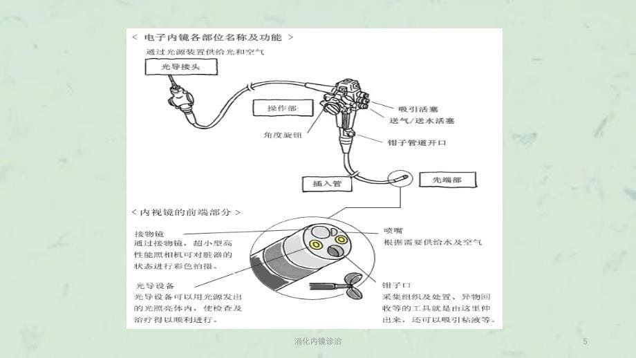 消化内镜诊治课件_第5页