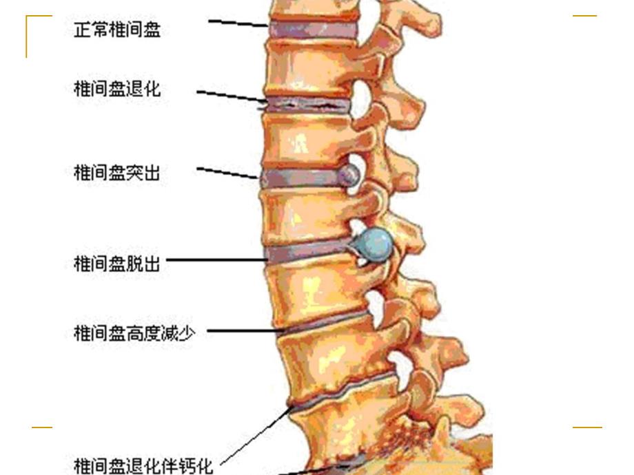 动态牵引治腰椎病_第3页