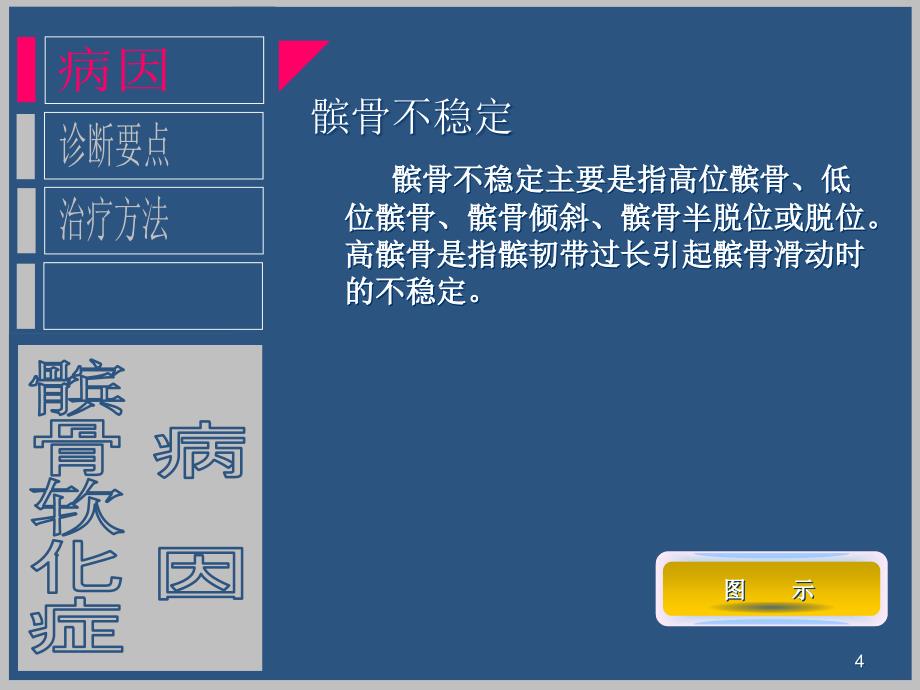 髌骨软化症诊断与治疗ppt演示课件_第4页