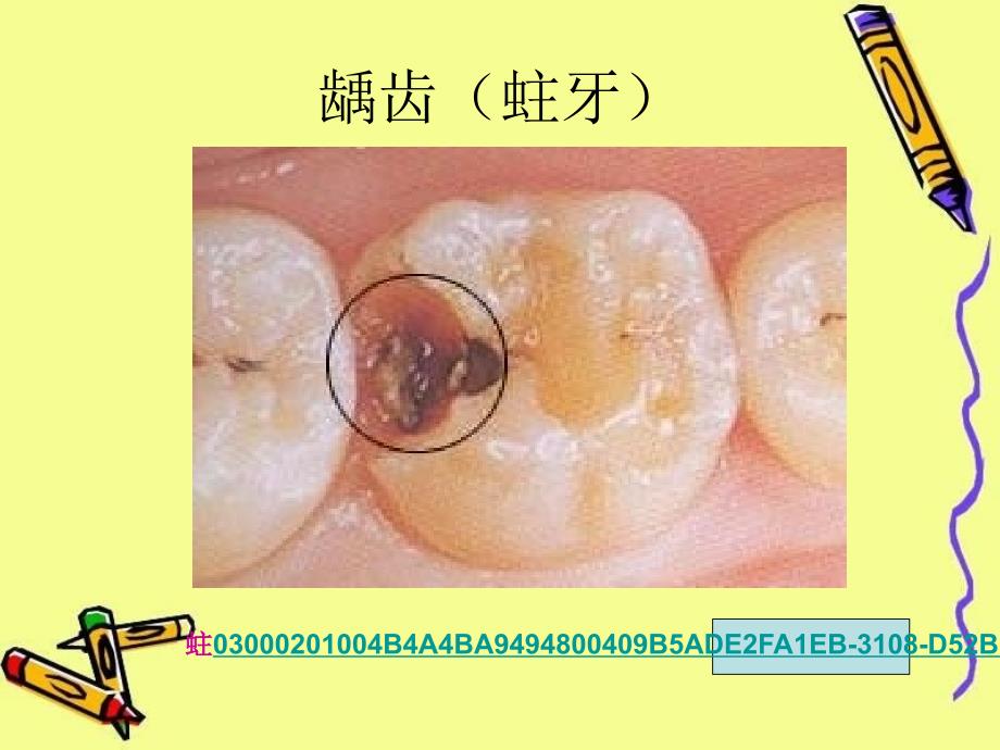 保护牙齿课件_第4页