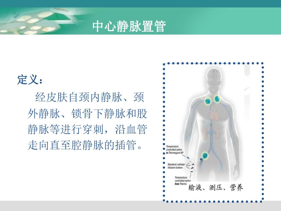 血液透析中心静脉导管的护理_第3页