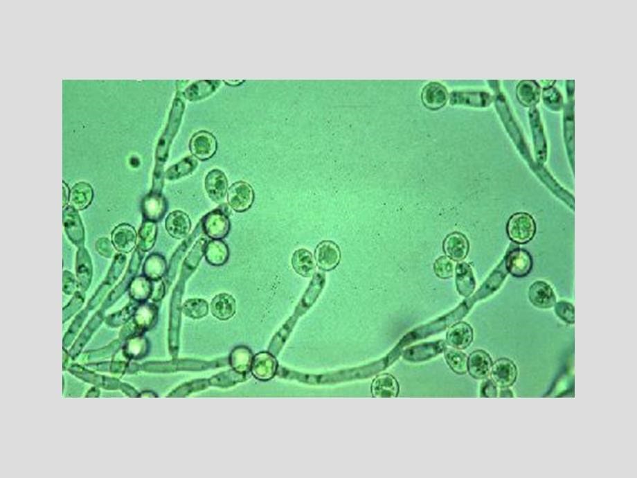 微生物学课件：第22章 引起侵袭性感染的真菌_第5页