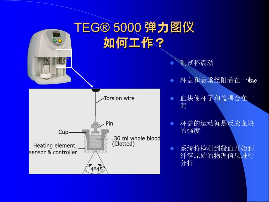 认识、鉴别TEG诊断报告.ppt_第4页