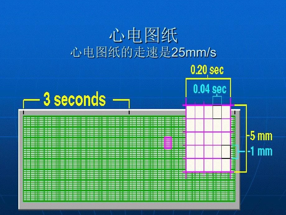 正常范围心电图PPT课件_第5页