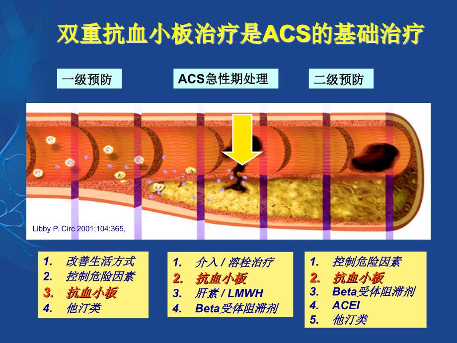 ACS患者抗血小板治疗_第4页