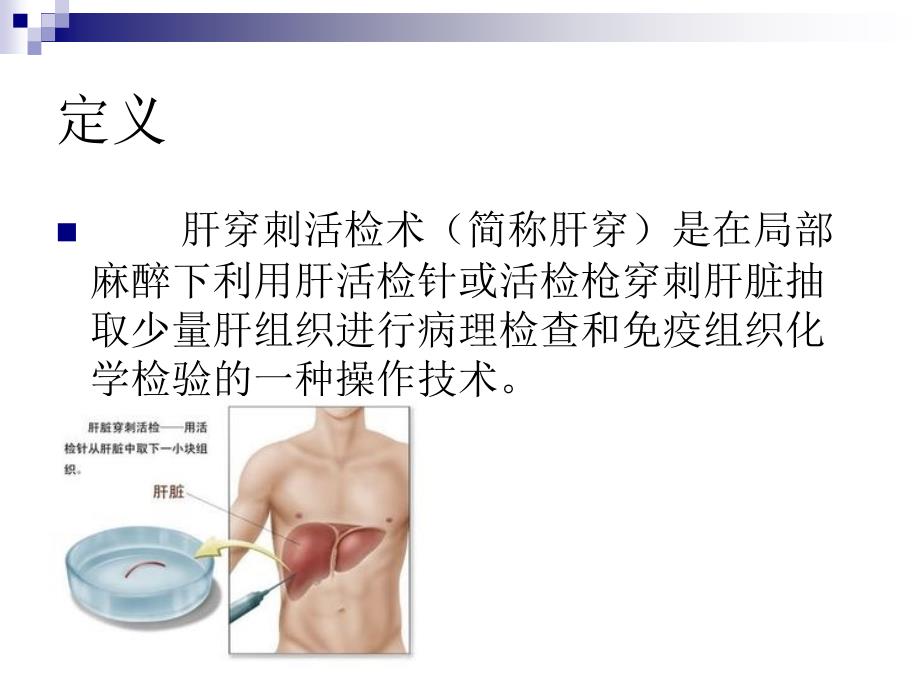 肝穿刺病人的护理.ppt_第3页