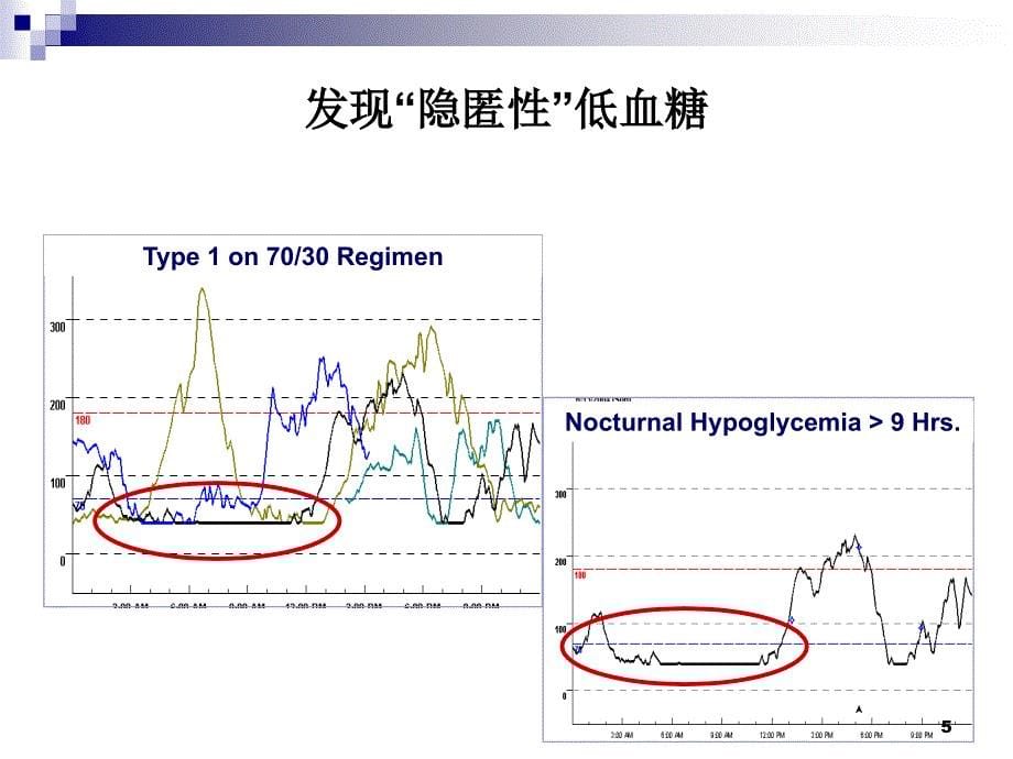 CGMS动态血糖监测图的临床意义及分析方法PPT优秀课件_第5页